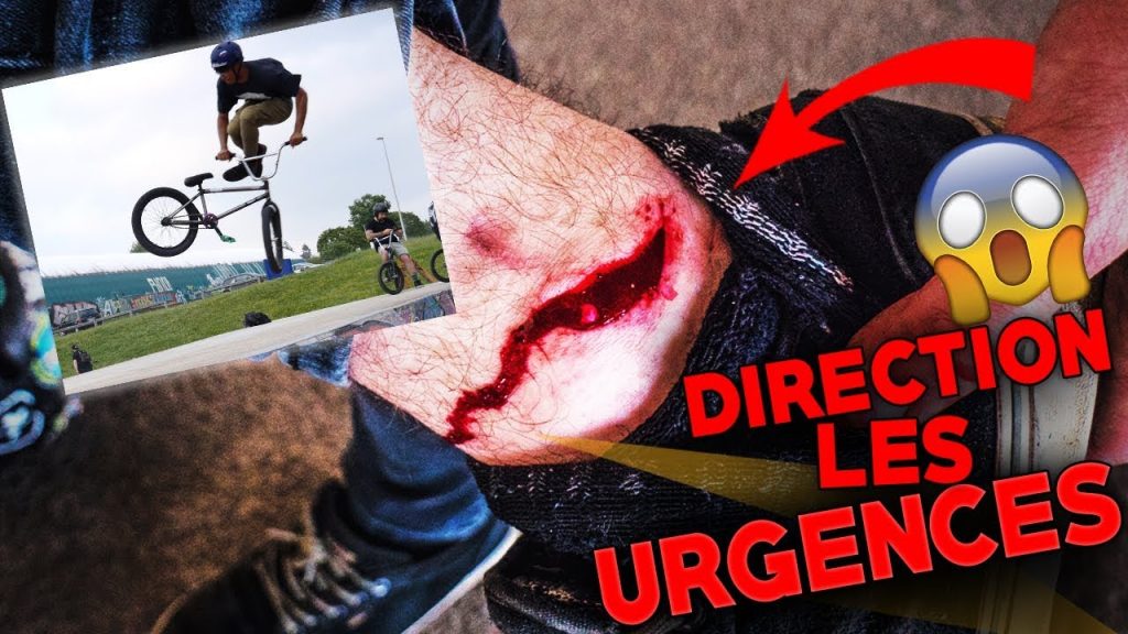 GROSSE BLESSURE EN BMX ! BMX DEATH CRASH !