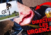 GROSSE BLESSURE EN BMX ! BMX DEATH CRASH ! GROSSE BLESSURE EN BMX ! BMX DEATH CRASH !
