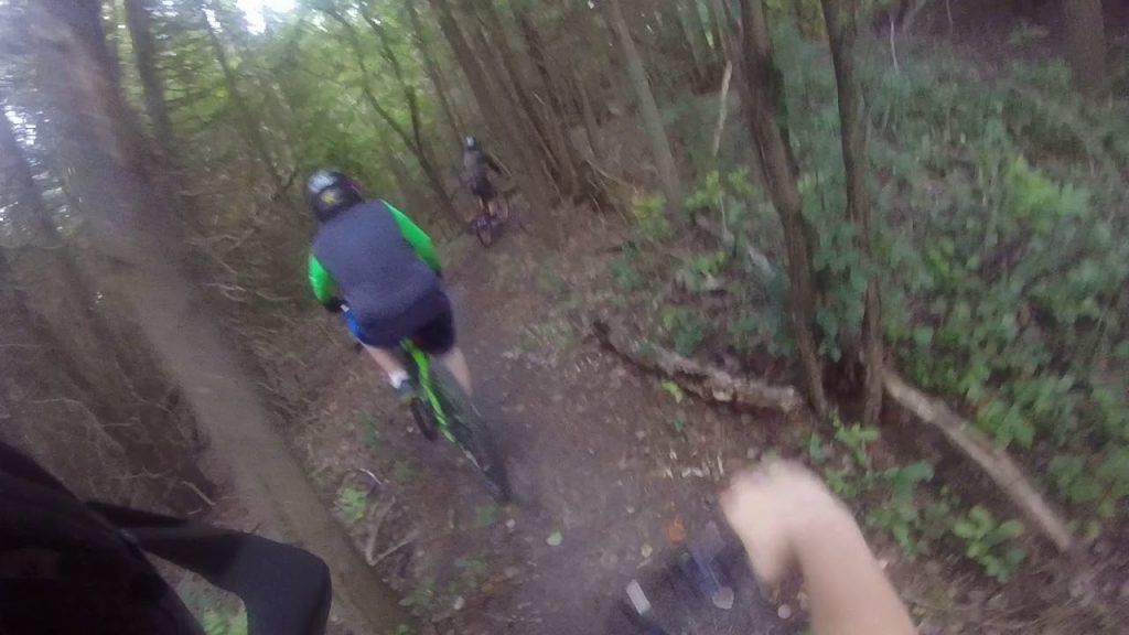 I broke my foot mountain biking in Ontario! MTB mountain bike fail broken bone