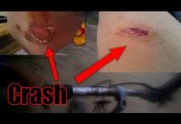 Epic fail crash Mountain Bike Epic fail crash Mountain Bike